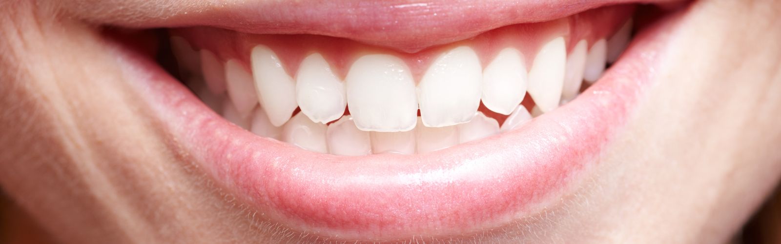Diş Protezleri image